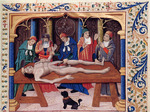 Anonymous - Autopsy. From Livre des propriétés des choses by Barthélemy l'Anglais