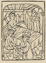 Anonymous - Syphilis treatment: Treatment with ointments (mercury). From: A Malafranczos morbo gallorum preservatio ac Cura von B. Steber
